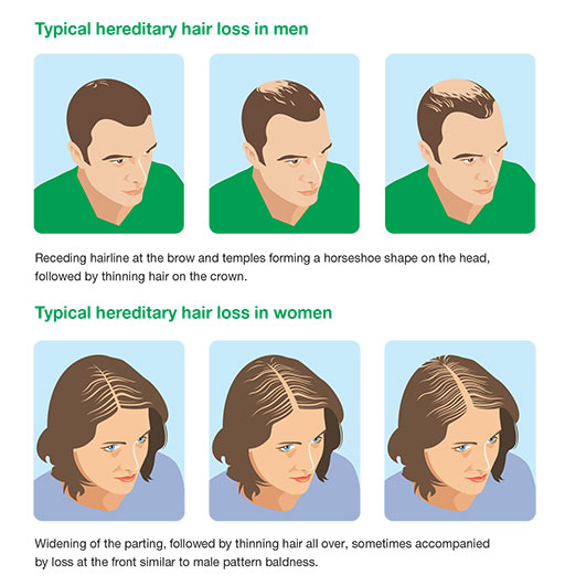 hair treatment clinic in gurgaon