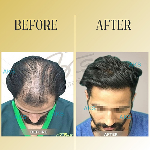 AKS clinic Before and After 10