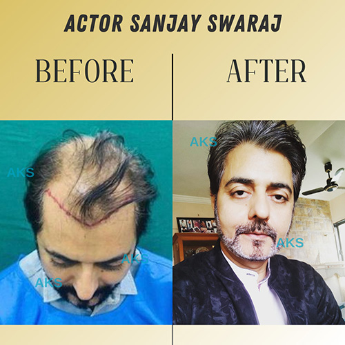 AKS clinic Before and After 1