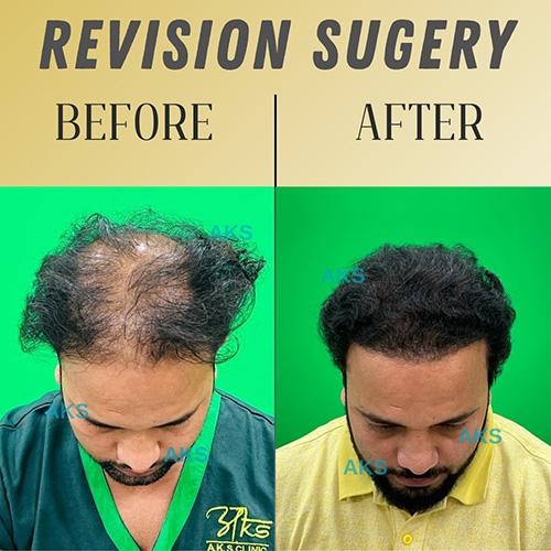 AKS clinic Before and After 3