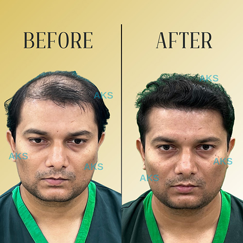 AKS clinic Before and After 5