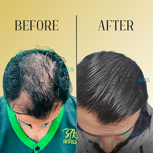 AKS clinic Before and After 4