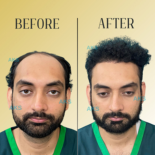 AKS clinic Before and After 6