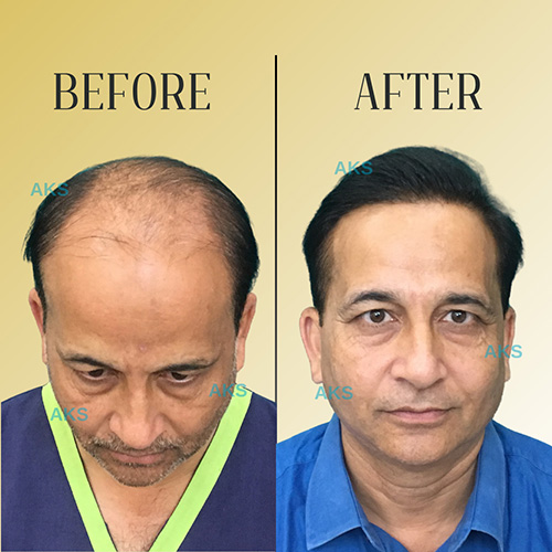 AKS clinic Before and After 7