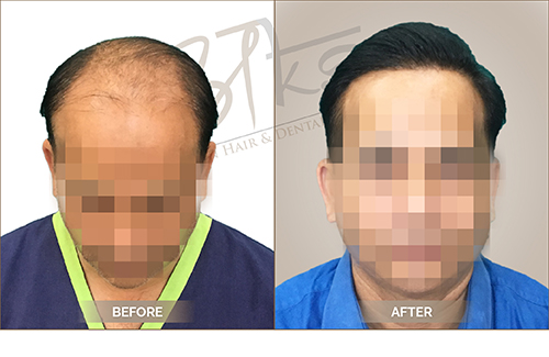 AKS Clinic Before and After