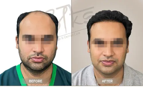 AKS Clinic Before and After