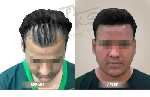 AKS Clinic Before and After