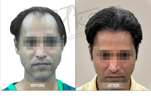 AKS Clinic Before and After