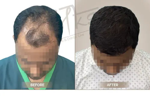 AKS Clinic Before and After