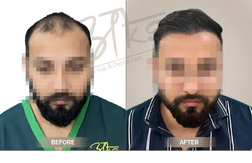 AKS Clinic Before and After