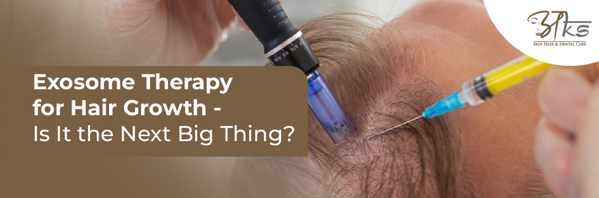 Exosome Therapy for Hair Growth