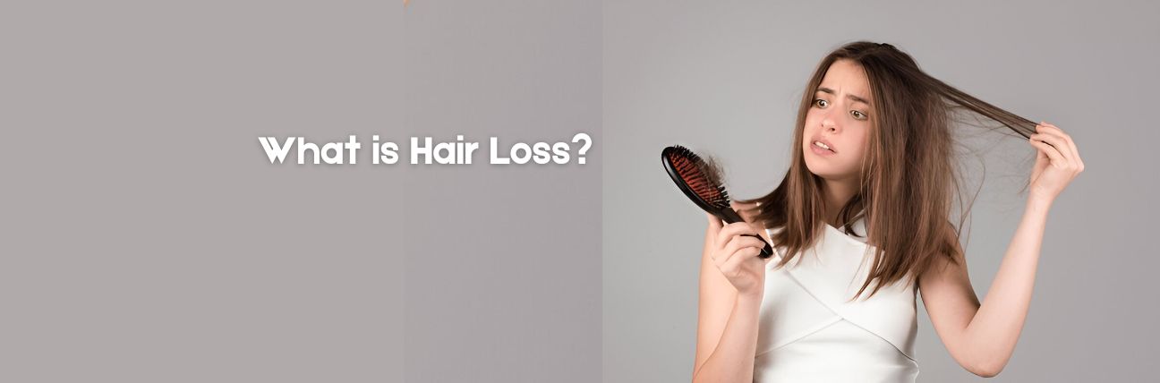 What is Hair Loss?