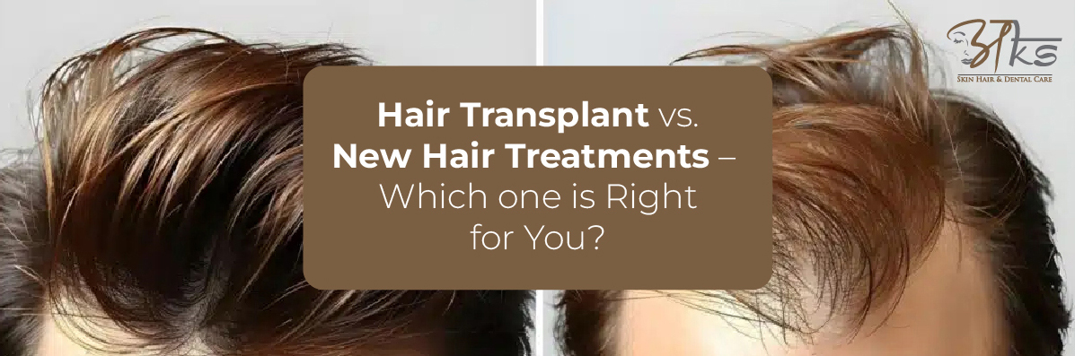 Hair Transplant vs. New Hair Treatments