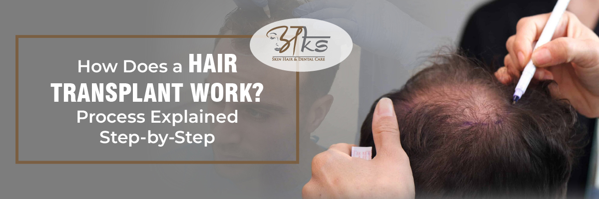 hair transplant work