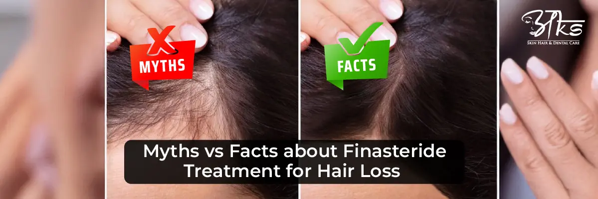 Myths vs Facts About Finasteride
