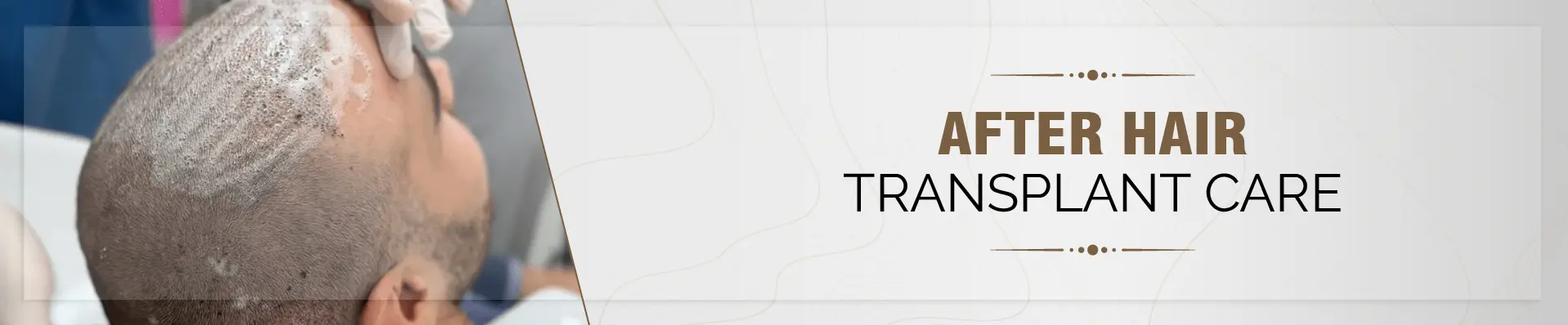 After Hair Transplant Care