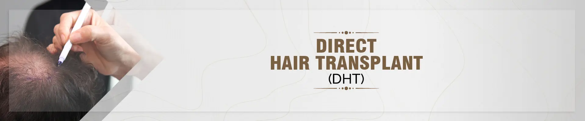 Direct Hair Transplant