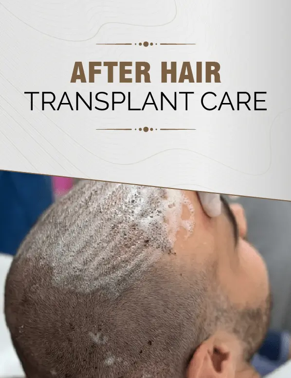 After Hair Transplant Care