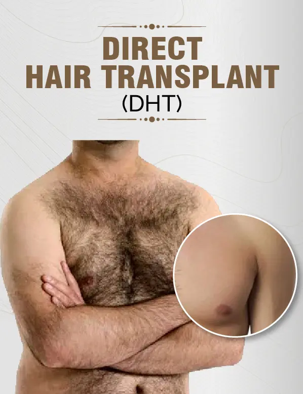 Body Hair Transplant