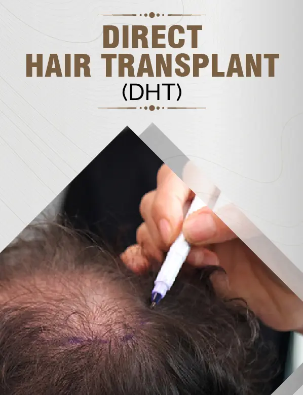 Direct Hair Transplant
