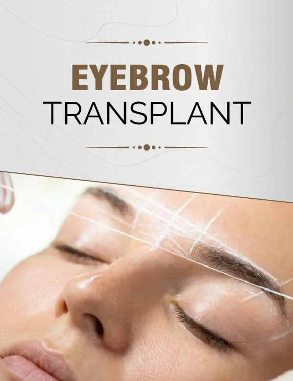 Eyebrow Transplant