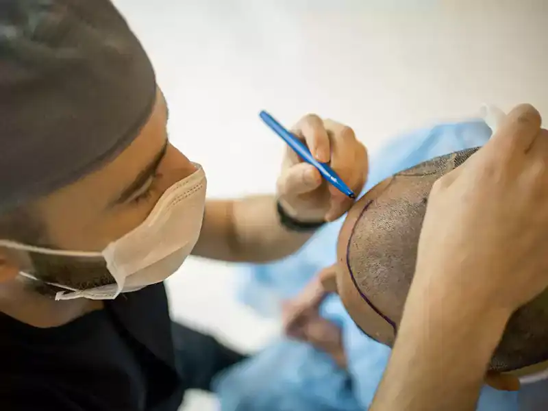 Hair Transplant Treatment Clinic in Gurgaon