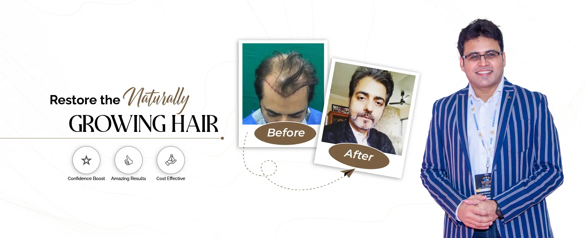 Direct Hair Transplant
